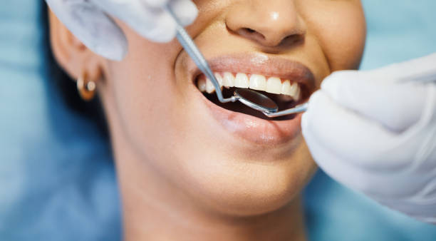 Best Emergency Dentist for Lost Fillings or Crowns in Lenwood, CA