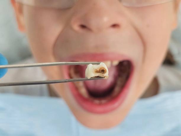 Best Pediatric Emergency Dentist in Lenwood, CA